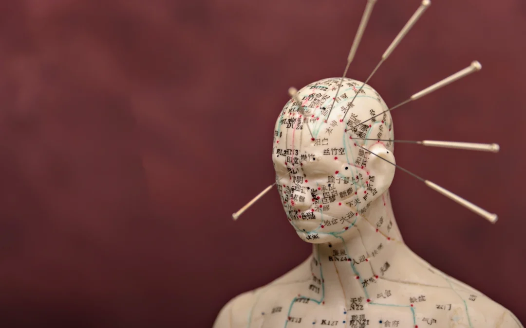 El tratamiento del dolor de cabeza en la Medicina China